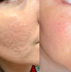 Celimax Pore+Dark Spot Brightening Cream 35ml