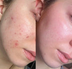Celimax Pore+Dark Spot Brightening Cream 35ml